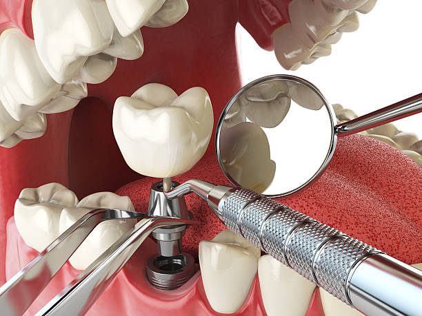 Best Same-Day Emergency Dental Services in Dahlgren, VA